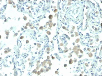 Mesothelin Antibody / MSLN