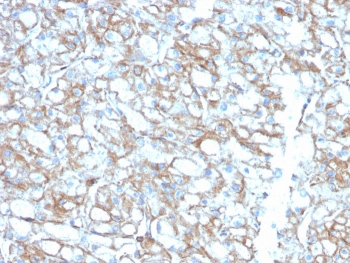 PD-L1 Antibody / B7-H1 / CD274