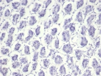 Nucleolin Antibody