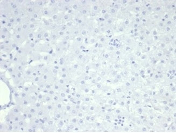 Nucleolin Antibody