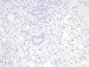Nucleolin Antibody