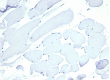 Nucleolin Antibody