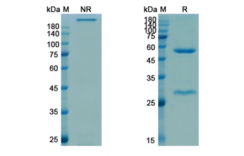Blosozumab (SOST(sclerostin)) - Research Grade Biosimilar