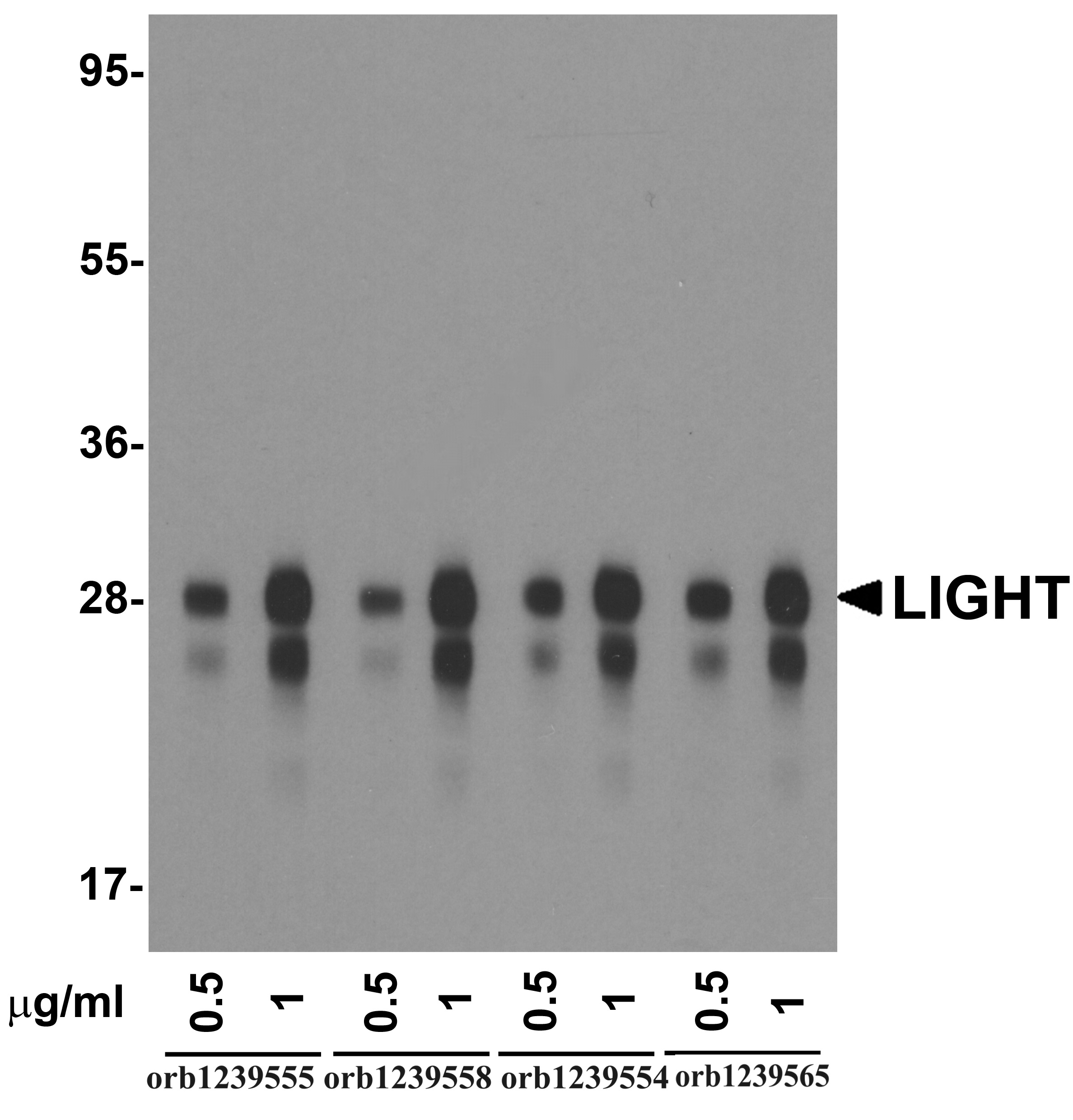 LIGHT Detection Set (Risk Free)