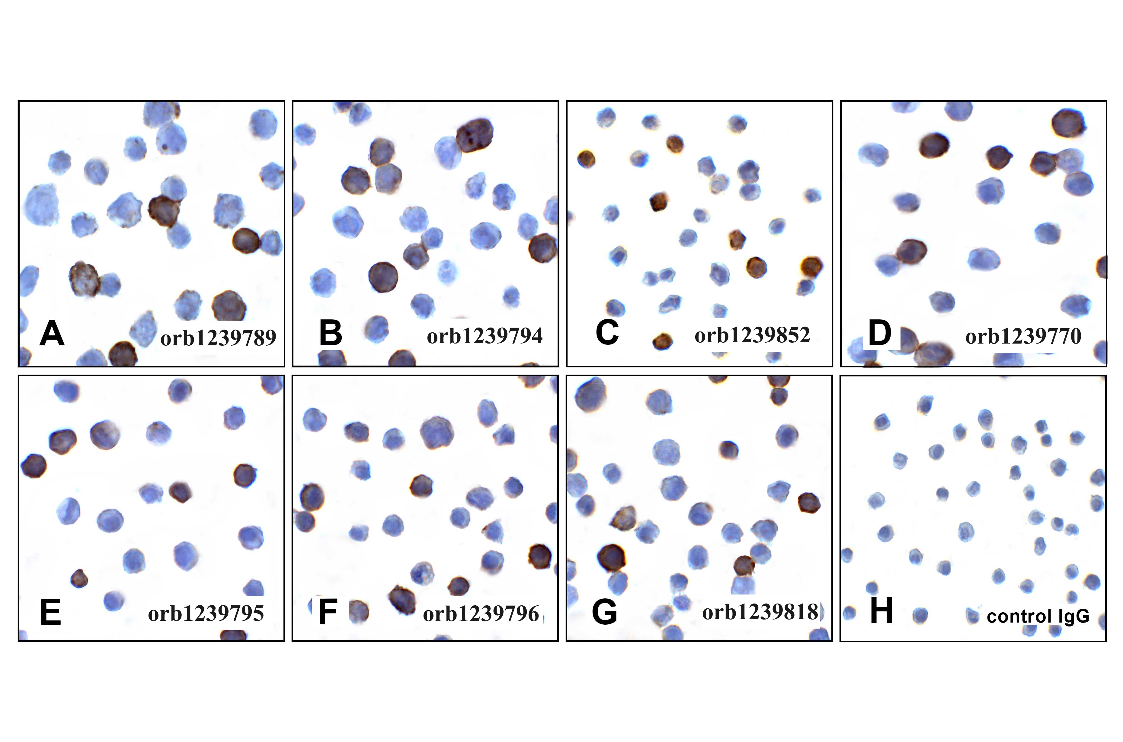 PDL1 Detection Set (Risk Free)