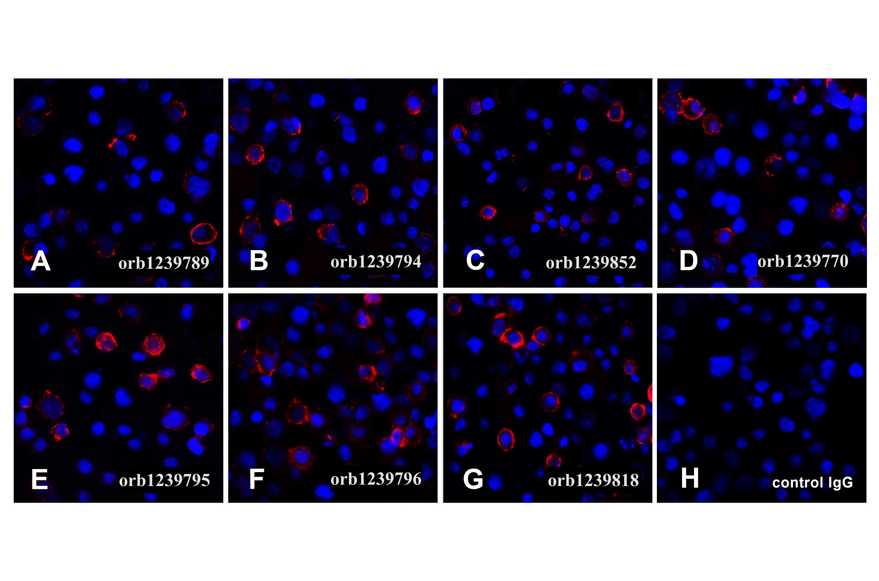 PDL1 Detection Set (Risk Free)