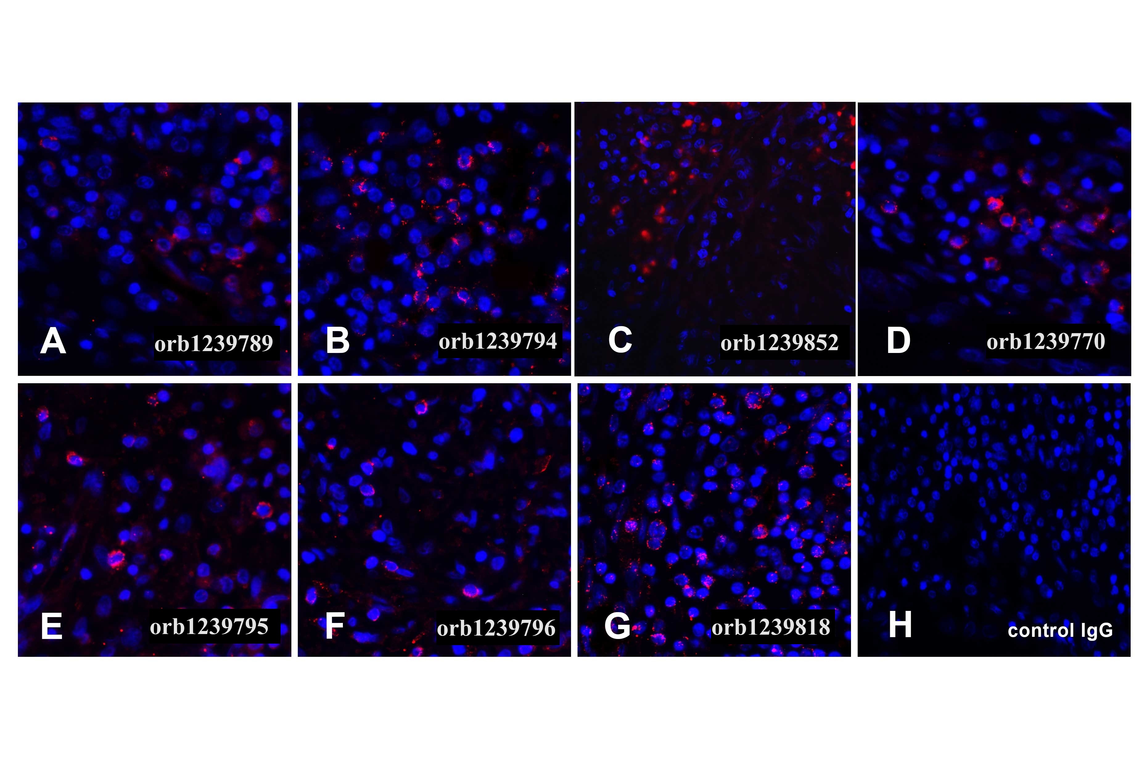PDL1 Detection Set (Risk Free)