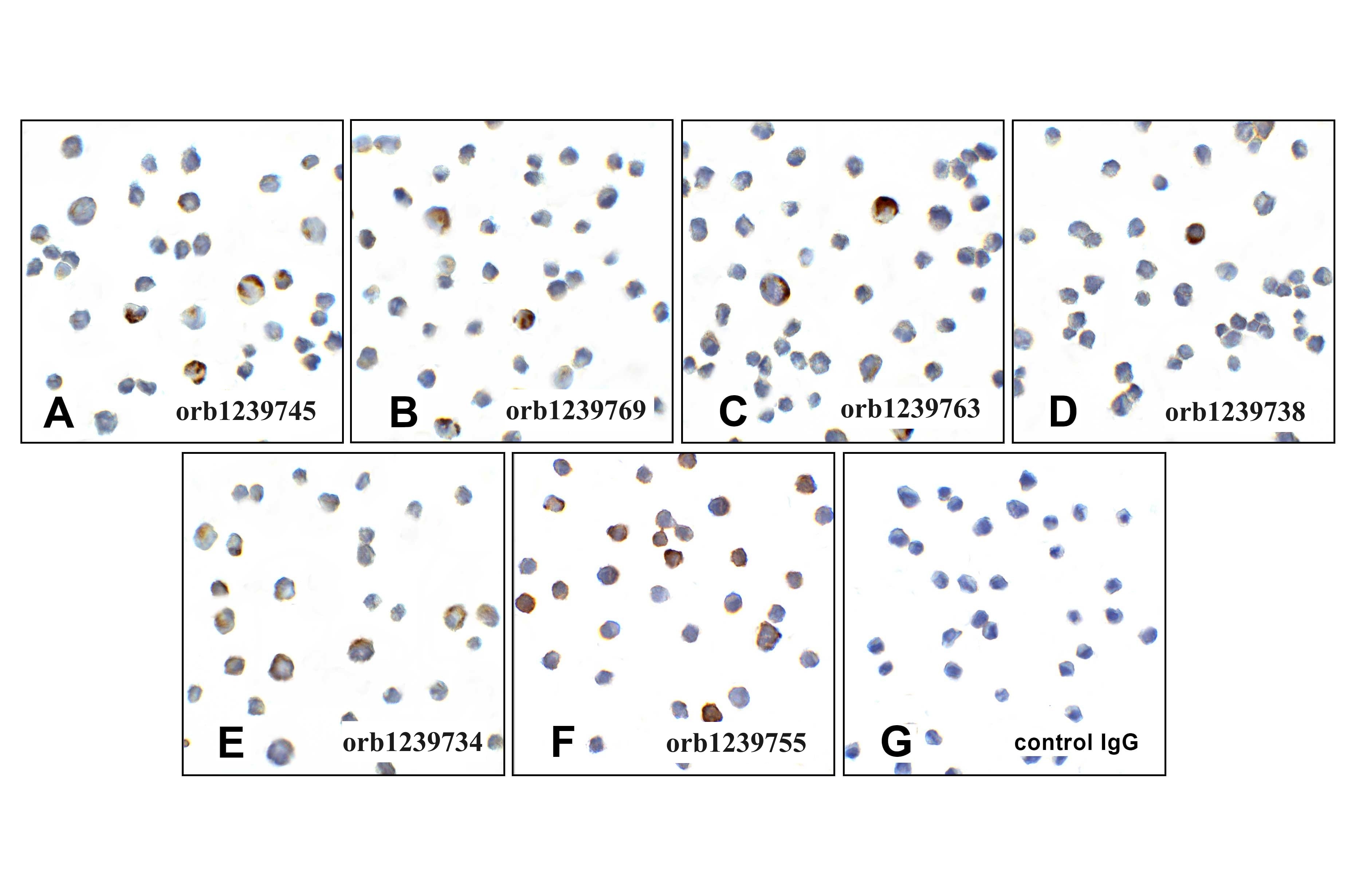 PD1 Detection Set (Risk Free)