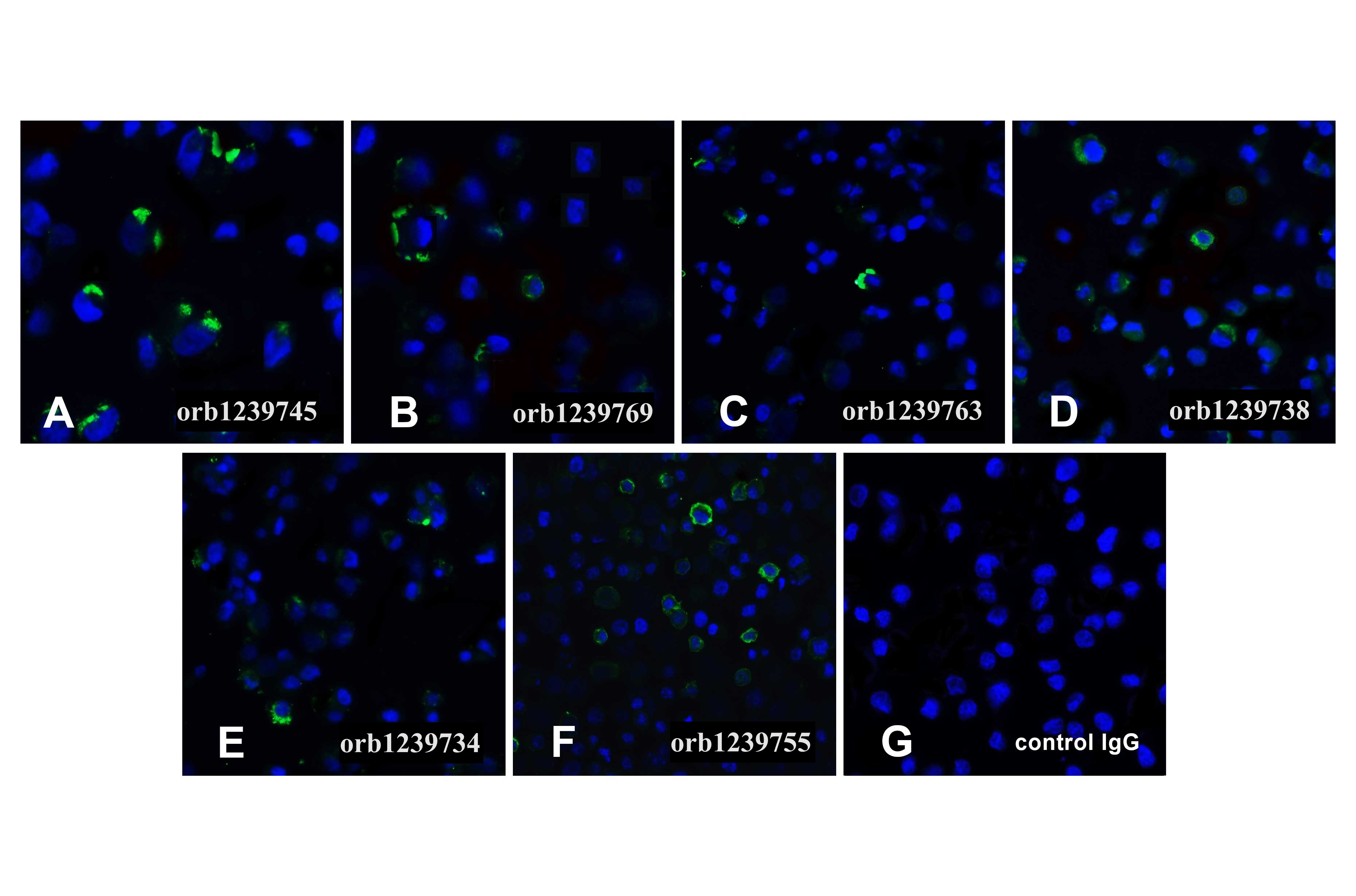 PD1 Detection Set (Risk Free)