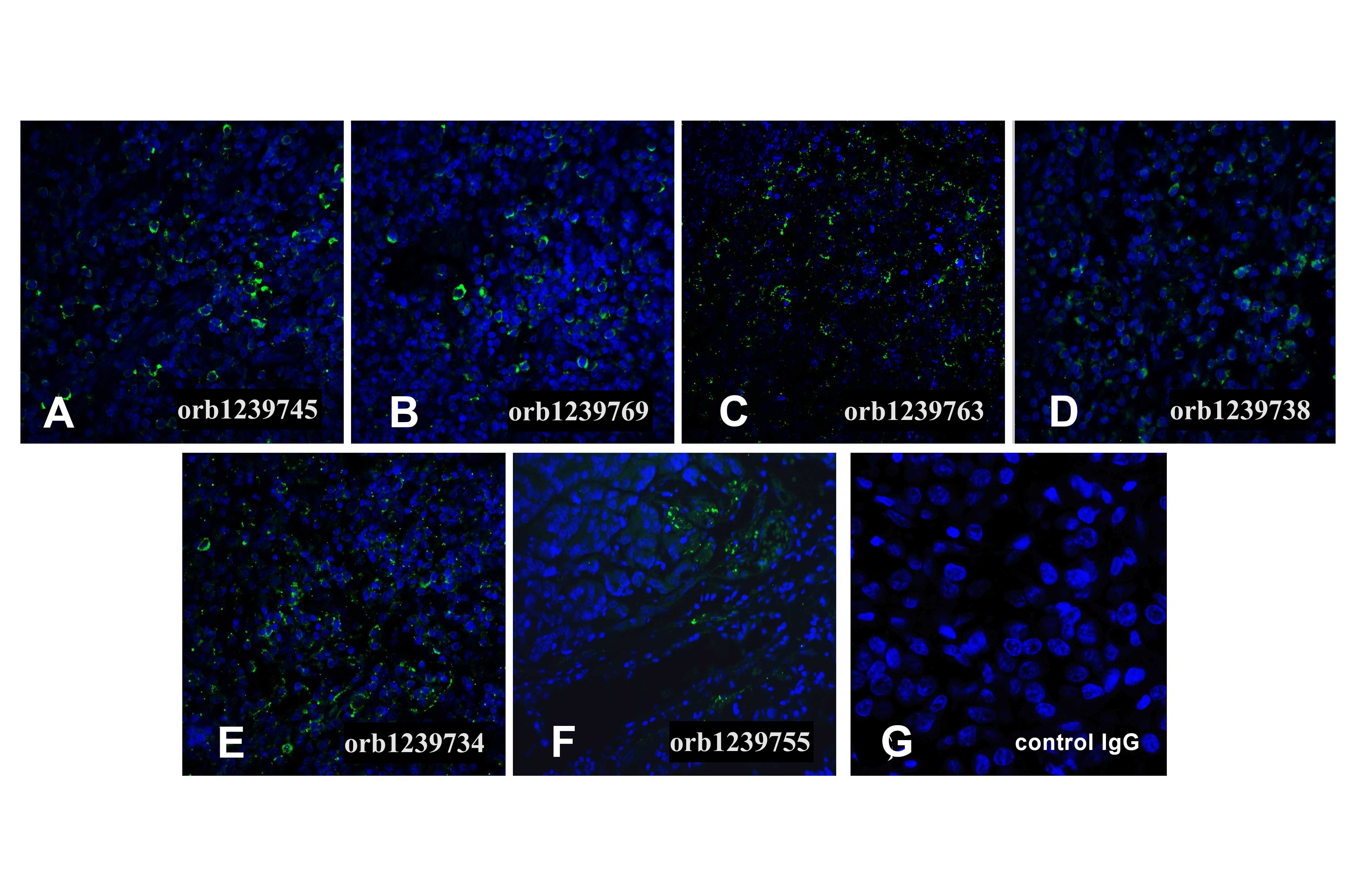 PD1 Detection Set (Risk Free)
