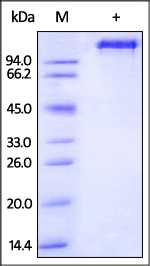 EGF R Recombinant Protein