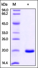 NME1 Recombinant Protein
