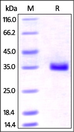 IGFBP-7 Recombinant Protein