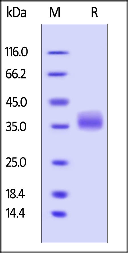 Galectin-3 Recombinant Protein