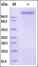 E-Selectin Recombinant Protein