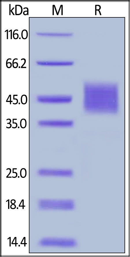 IL-4 R alpha Recombinant Protein