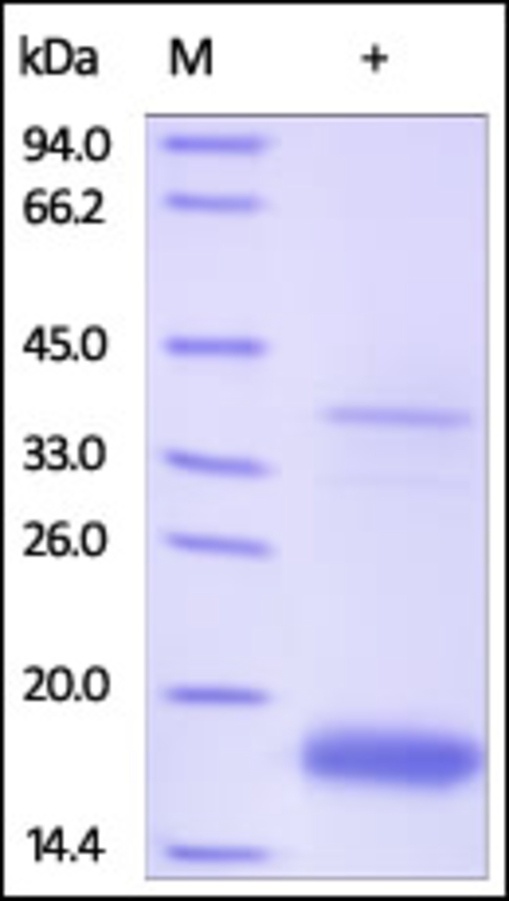 Transthyretin Recombinant Protein