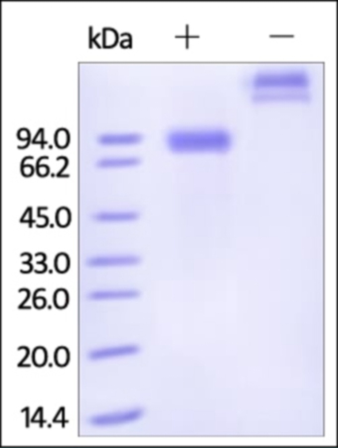 SIGLEC6 Recombinant Protein