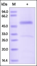 Serpin H1 Recombinant Protein
