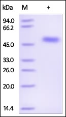 Serpin F1 Recombinant Protein