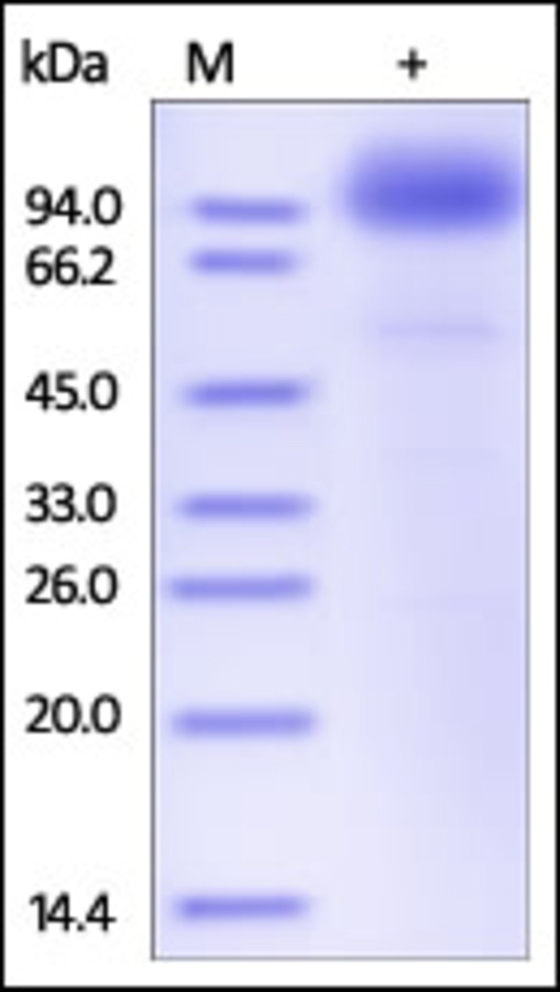 SCARB2 Recombinant Protein