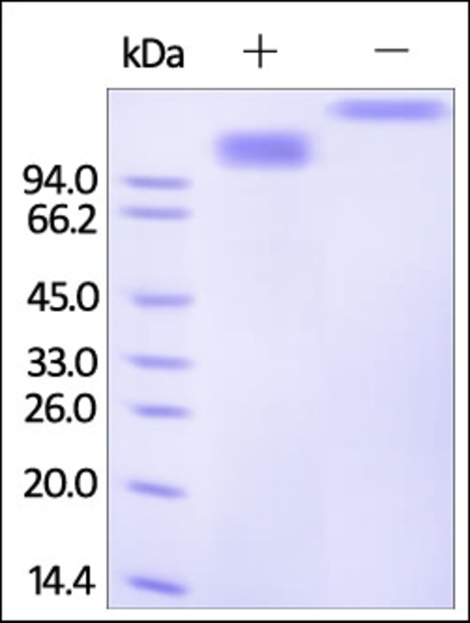 SCARB1 Recombinant Protein