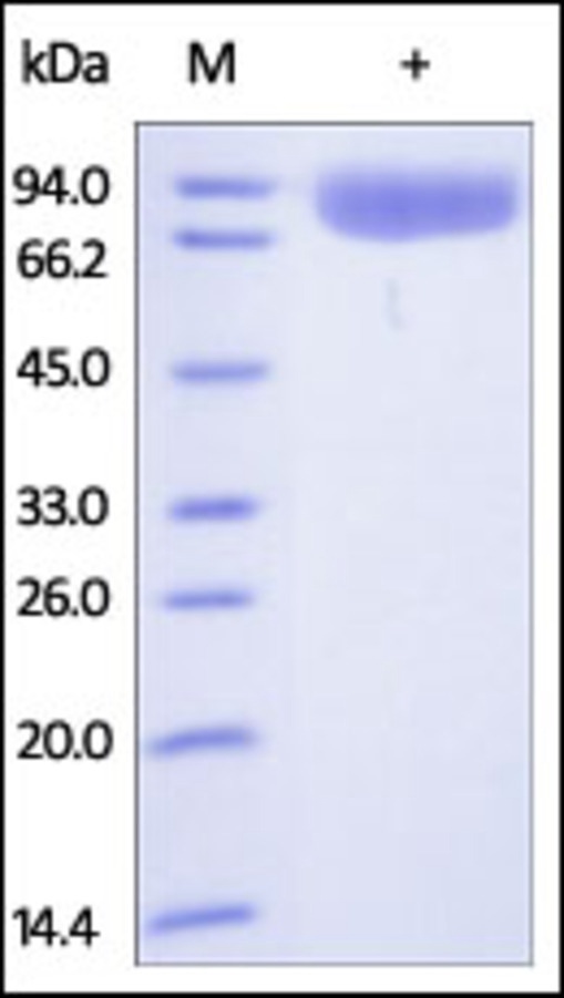 Poly Ig receptor Recombinant Protein