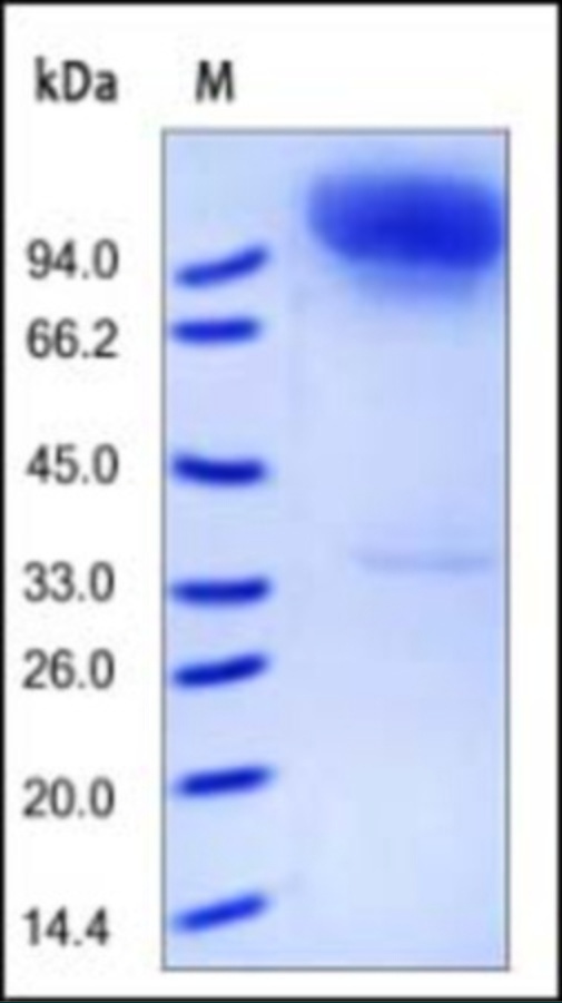 Neprilysin Recombinant Protein