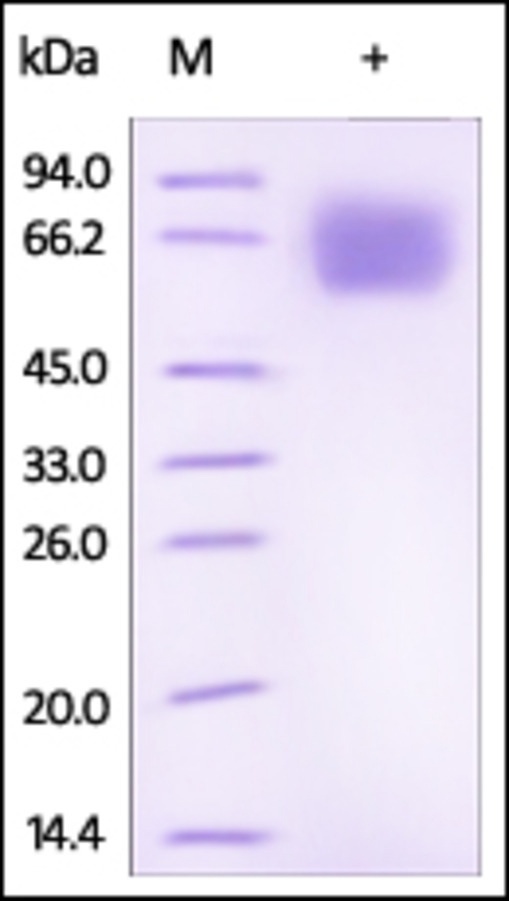 IL18 BP Recombinant Protein