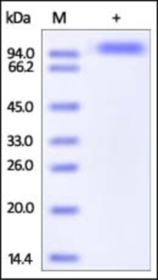 WSX 1 Recombinant Protein