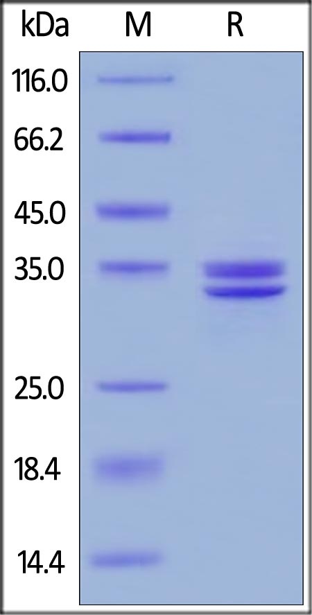 HMGB1 Recombinant Protein