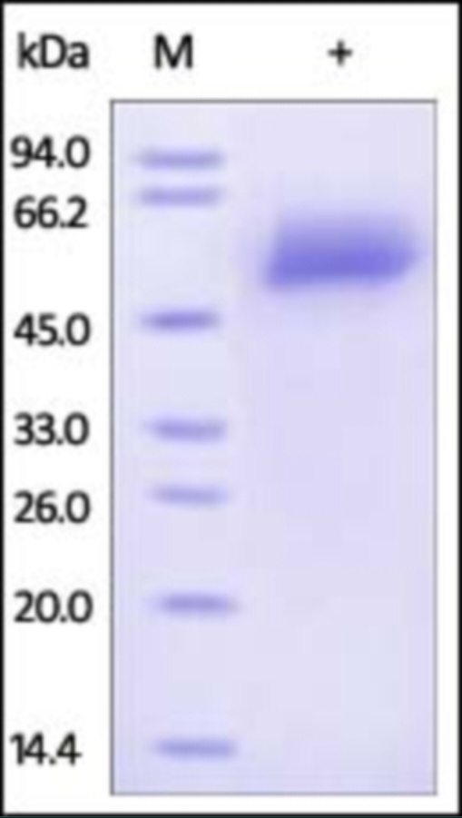Fetuin A Recombinant Protein