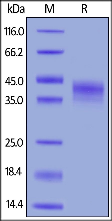 DKK 1 Recombinant Protein