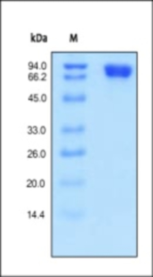 MCAM Recombinant Protein