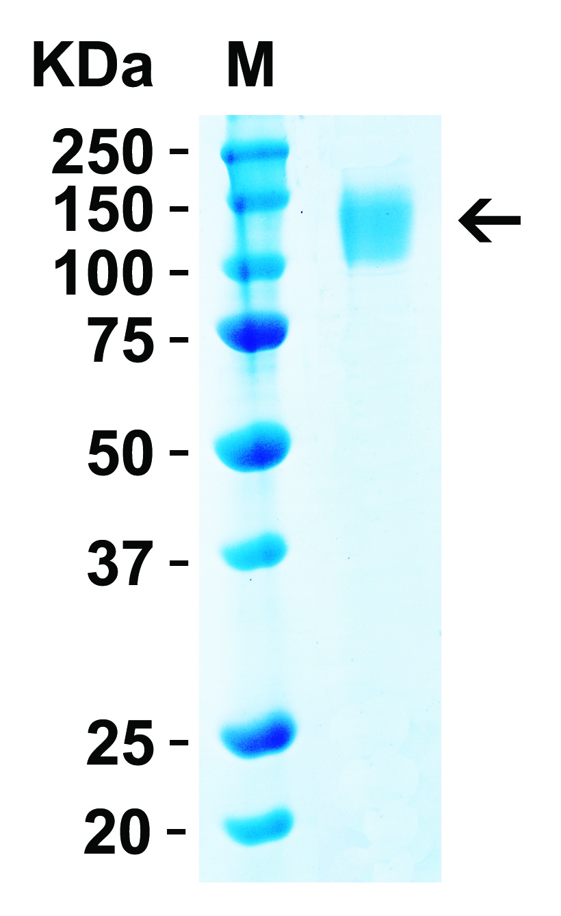 SARS-CoV-2 (COVID-19) Delta Variant Spike S1 (His-Avi Tag) Recombinant Protein