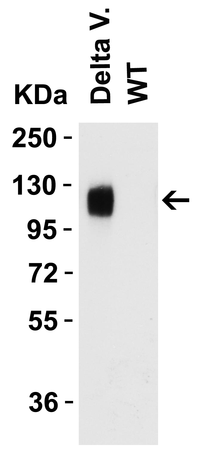 SARS-CoV-2 (COVID-19) Delta Variant Spike S1 (His-Avi Tag) Recombinant Protein