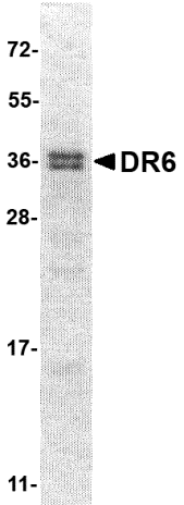 DR6 Cytoplasmic Domain Recombinant Protein