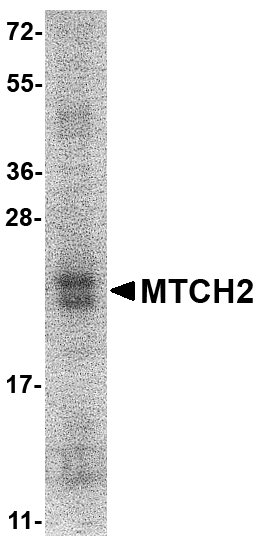 MTCH2 Recombinant Protein