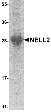 NELL2 Recombinant Protein