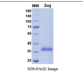 SARS-CoV-2 (COVID-19) Delta Variant (B.1.617.2) Spike RBD (L452R, T478K) Recombinant Protein