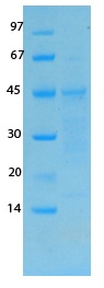 SARS-CoV-2 (COVID-19) Membrane Recombinant Protein
