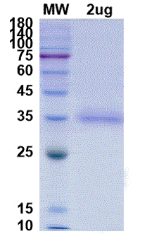 SARS-CoV-2 (COVID-19) Variant (B.1.429, Ca .20C) Spike RBD (L452R) Recombinant Protein