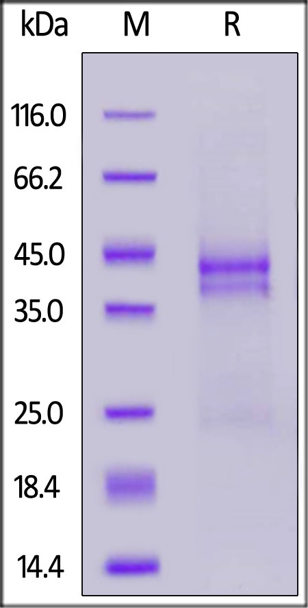 CTGF / CCN2 Recombinant Protein