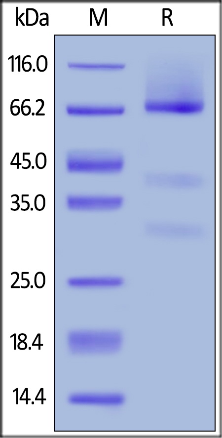 Glypican 3 / GPC3 Recombinant Protein