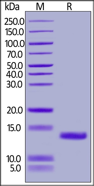 Complement Component C5a Recombinant Protein