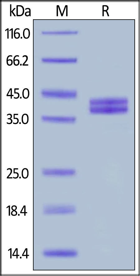 Complement Component C5a Recombinant Protein