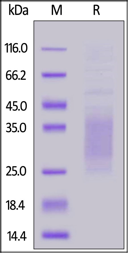 TREM2 Recombinant Protein
