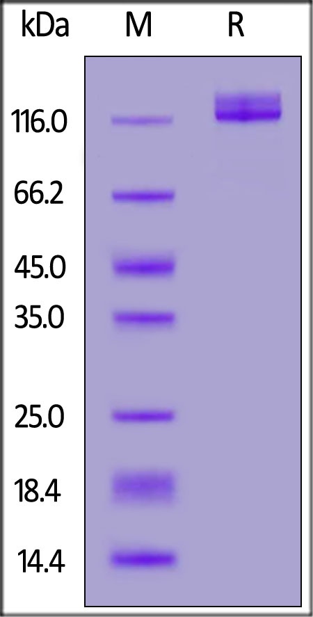 ENPP3 / CD203c Recombinant Protein