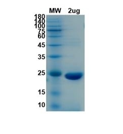 SARS-CoV-2 (COVID-19) NSP8 Recombinant Protein