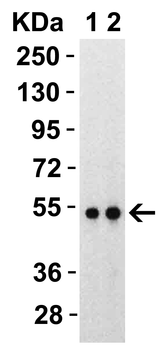 SARS-CoV-2 (COVID-19) Nucleocapsid Recombinant Protein